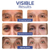 Load image into Gallery viewer, flysmus™ RENEWEYES Pigmented Correcting Firming Eye Cream