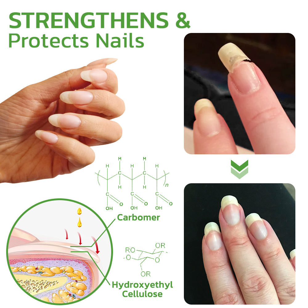 GFOUK™ 5 Days Nail Growth and Hardening Repair Roller