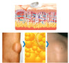 Load image into Gallery viewer, CurSkin™ Lipoma Treatment Ointment